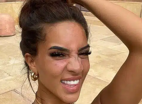 « Ceci n’est pas un filtre », Marwa balance des photos d’elle défigurée juste après plusieurs injections