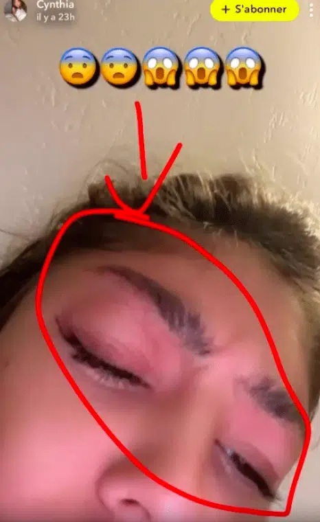 Cynthia Makhoul : Après une photo de son visage défiguré, elle fait passer un important message