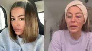 Anaïs Camizuli (Les cinquante) “défigurée” suite à une violente agression par un inconnu